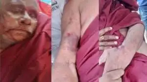An aged Buddhist monk attacked in Ukhia, condemned by Oikya Parishad