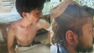 ঘাগড়ায় বিজু উৎসবের সময় সেটেলার বাঙালি কর্তৃক জুম্মদের উপর হামলা, আহত ২০